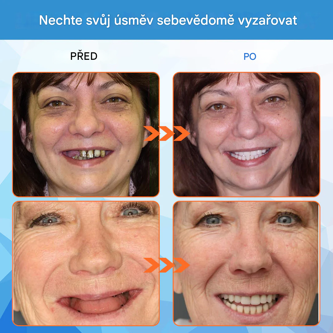 Zubní lékaři důrazně doporučují – keramické zubní náhrady pro seniory（AQY）